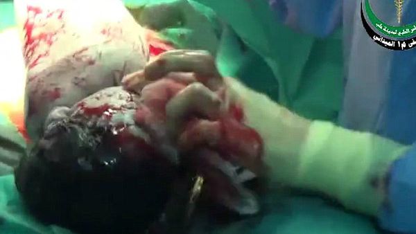 Amal/ Perchè Dio ha estratto un proiettile dalla testa di una neonata siriana