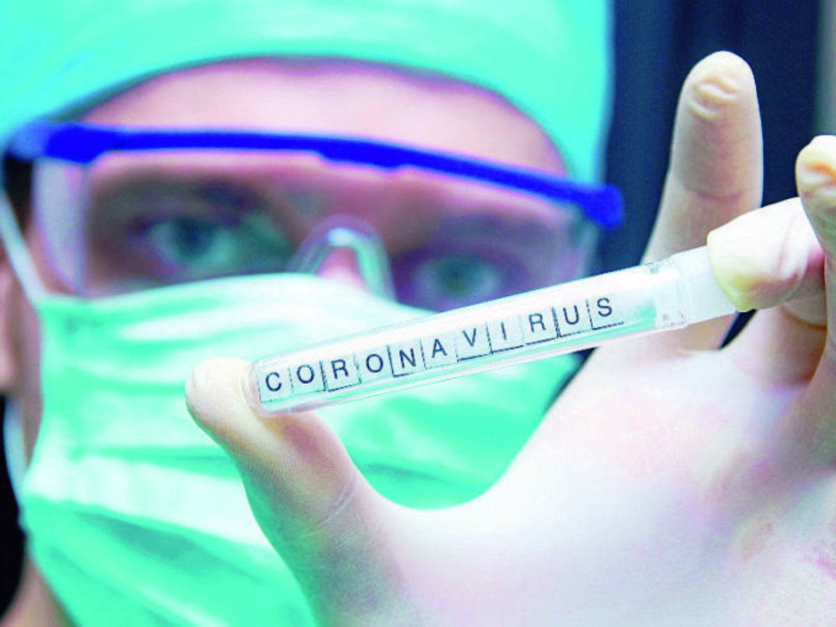 Coronavirus. Ottenuto a Padova il test europeo per la diagnosi2