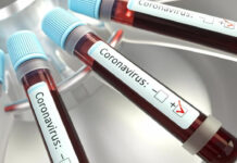 Coronavirus (romasette.it)