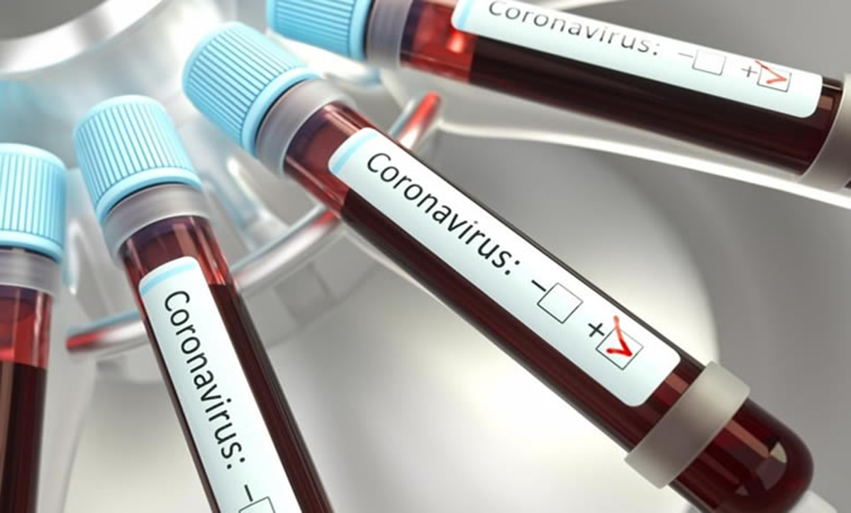 Li-Meng Yan - Denuncia sul Coronavirus